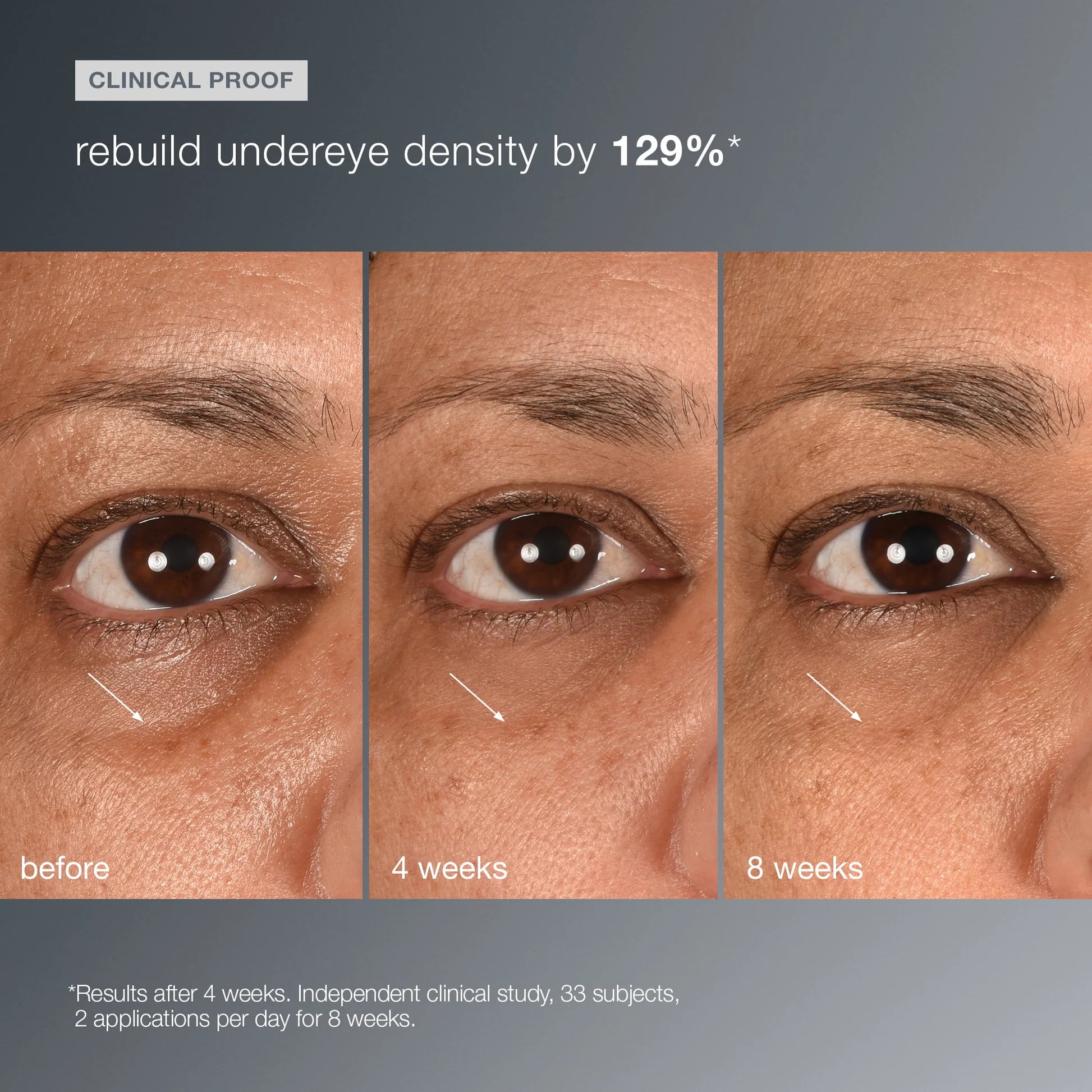 Smart Eye Density Undereye Serum